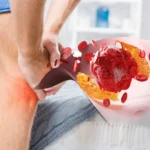 Penyebab Nyeri Sendi dan Cara Mengatasinya