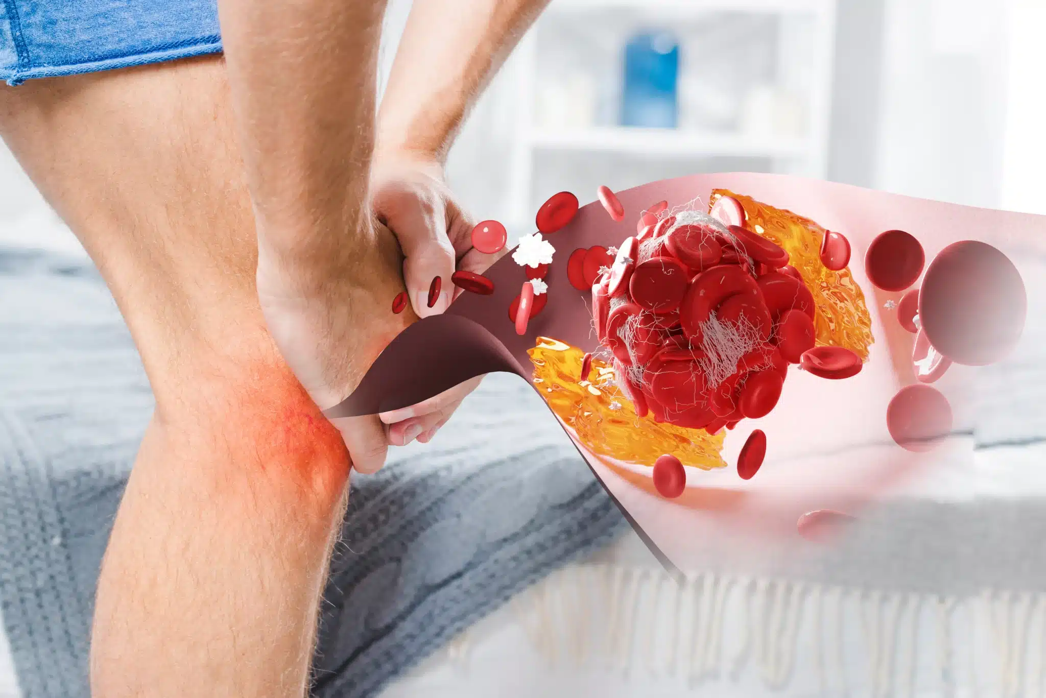 Manfaat Wildbee Kapsul, Herbal Asam Urat, Obat Nyeri Sendi, Obat Nyeri Lutut, Obat Sakit Pinggang